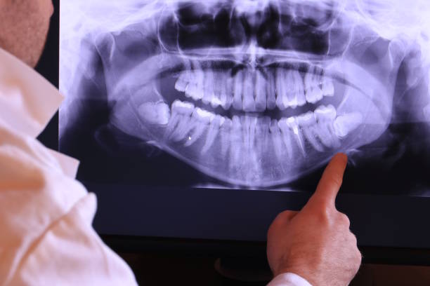 Best Emergency Dental Surgery in Sylvan Lake, MI