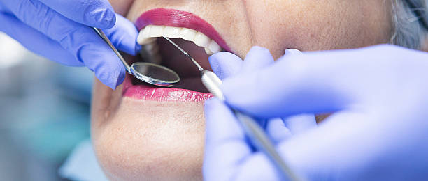 Best Emergency Tooth Extraction in Sylvan Lake, MI