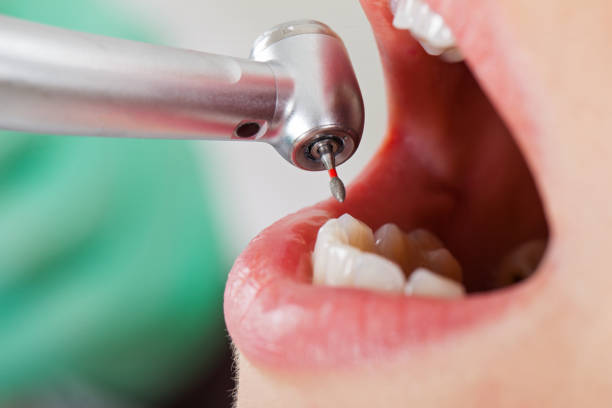 Best Emergency Broken Tooth Repair in Sylvan Lake, MI